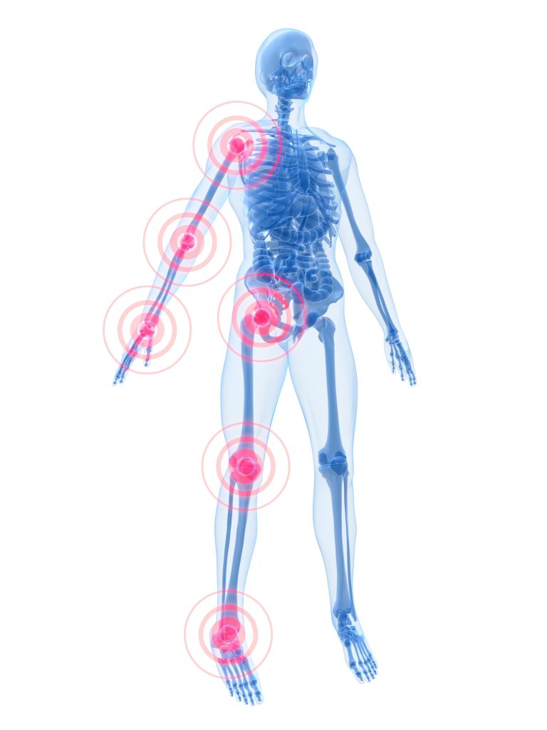 skeleton, nervous system, pain